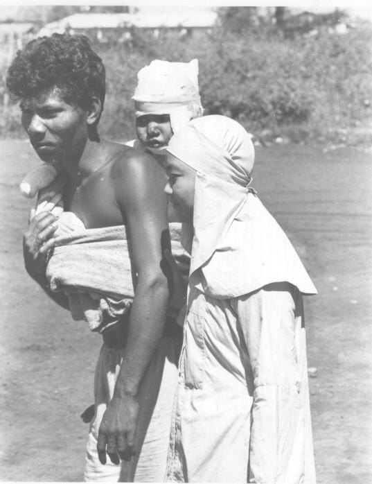 A man carrying a badly burned baby wrapped in cloth, a woman beside him