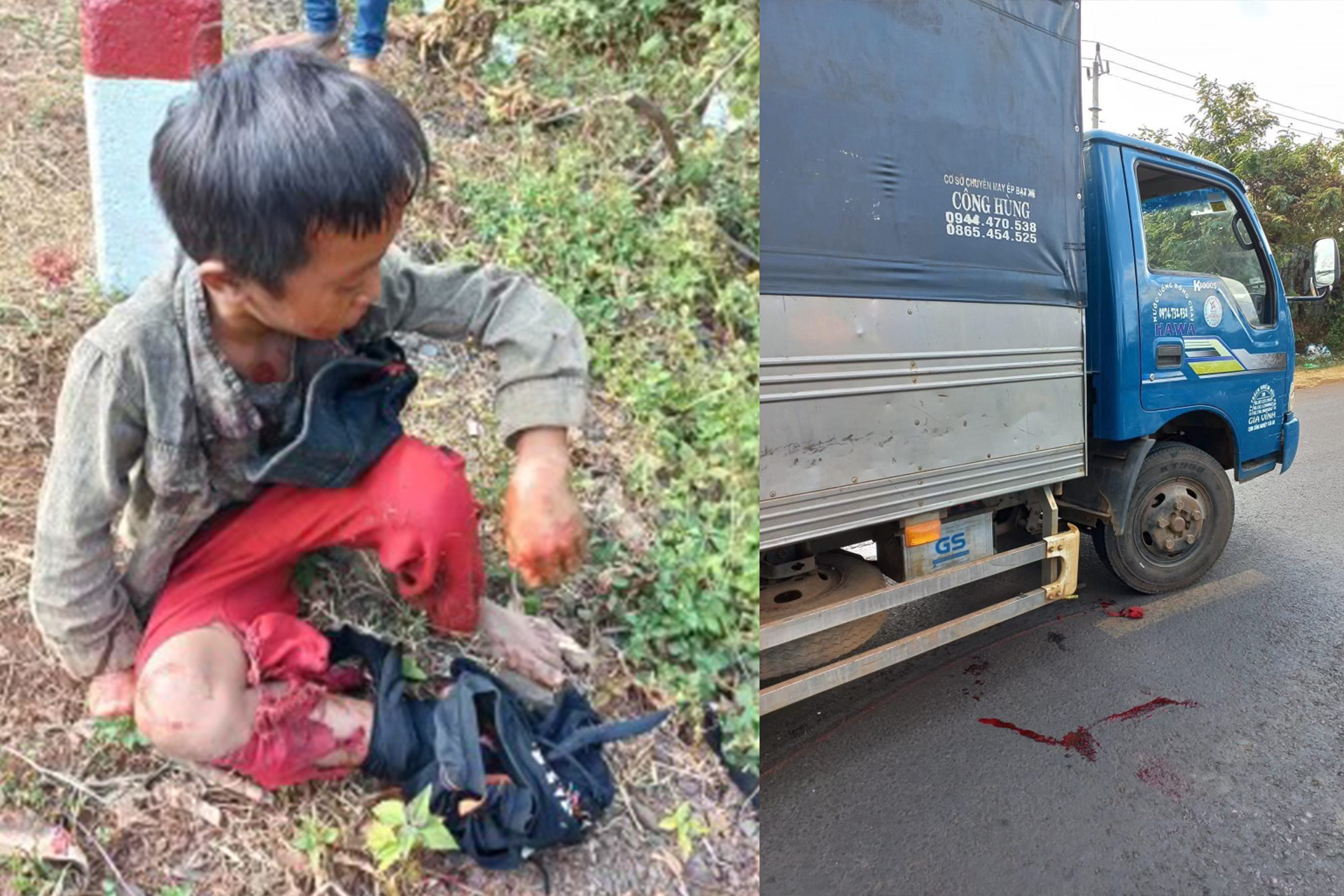7 Years Old Dega Boy Hit And Run By A Vietnamese Truck