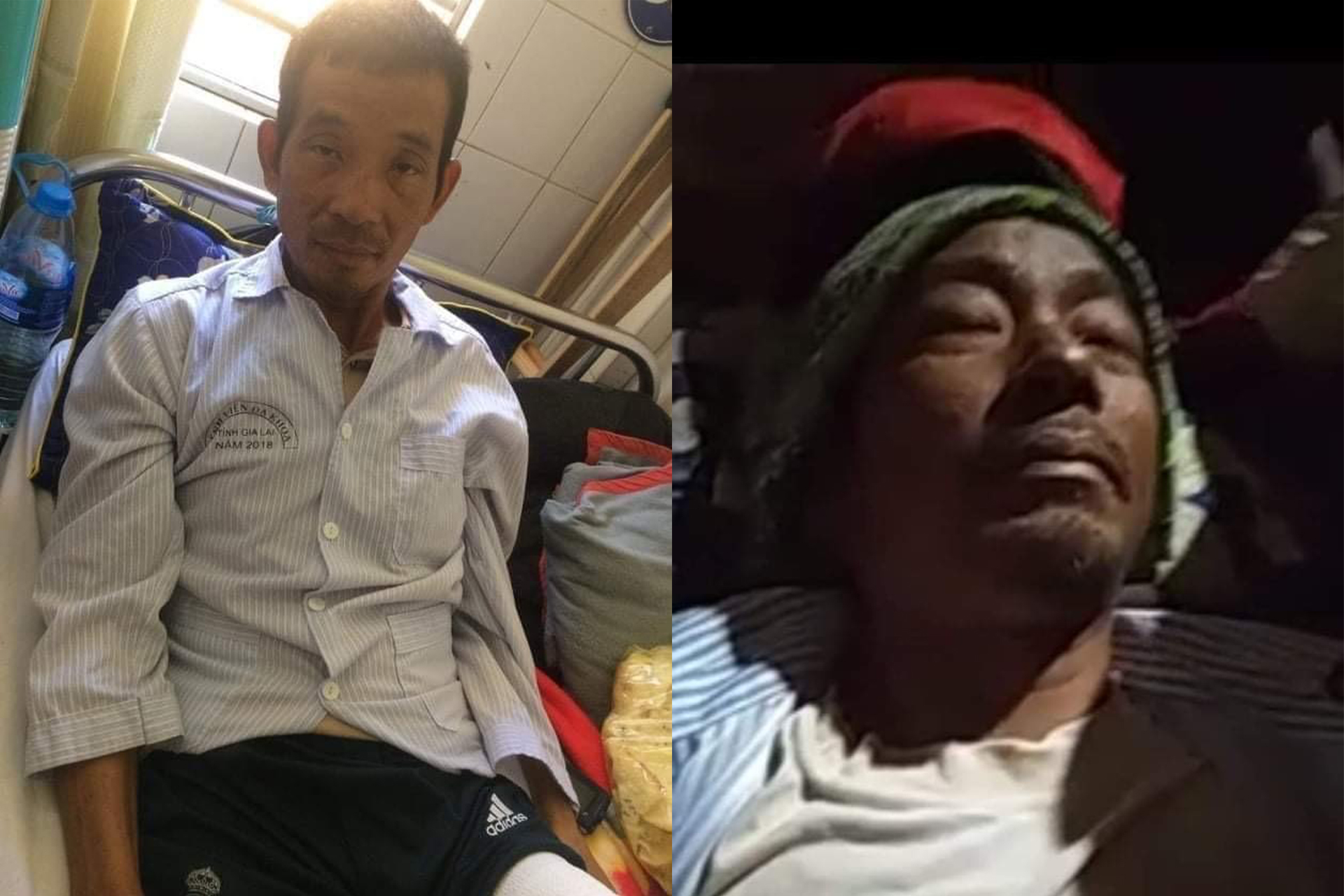 The Vietnamese Police Cut Off A Dega Leg And Died
